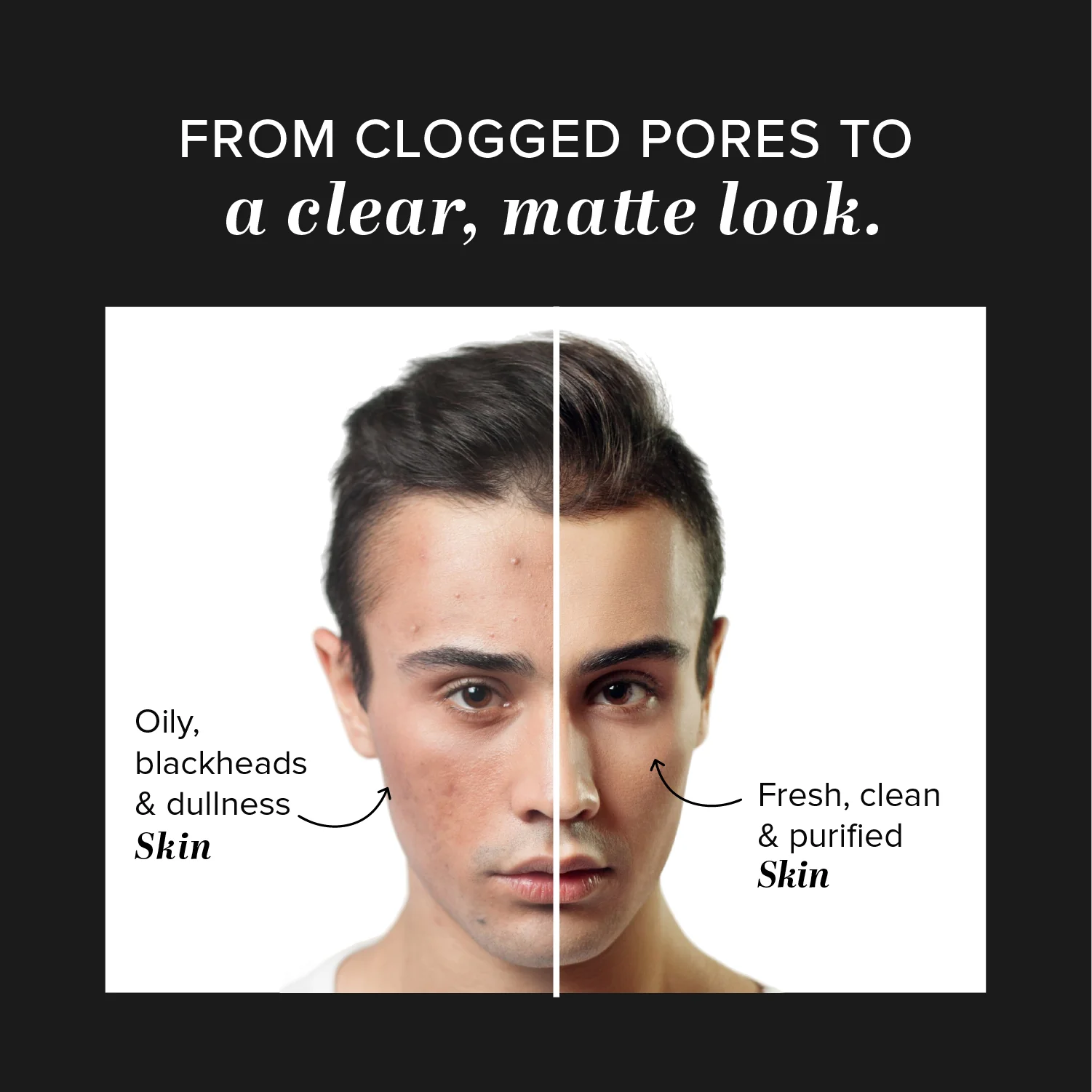 Khadi Natural Activated Bamboo Charcoal Peel Off Mask - 100gm - Image 7